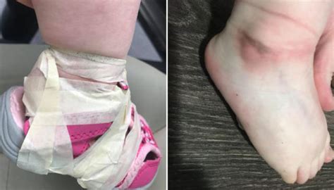 mother s horror after daughter s feet taped into shoes