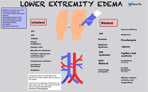 Peripheral Edema Differential Diagnosis Framework Grepmed