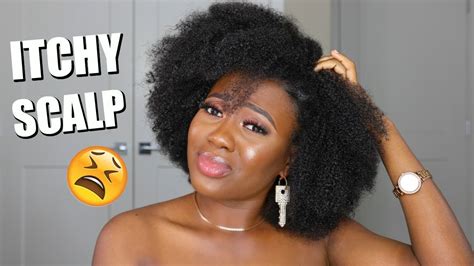 Natural Hair Itchy Scalp Dandruff Flaky And Dry Scalp How To Get Rid Of