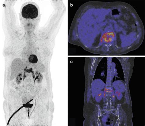 Nuclear Medicine Imaging Techniques Radiology Key