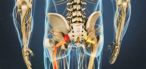It is a large depressed area that lies near the centre of the medial surface. Sciatic Pain Treatment Orange City FL