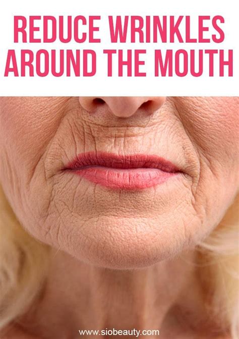 How To Treat Wrinkles Around The Mouth Lip Wrinkle Treatment How To
