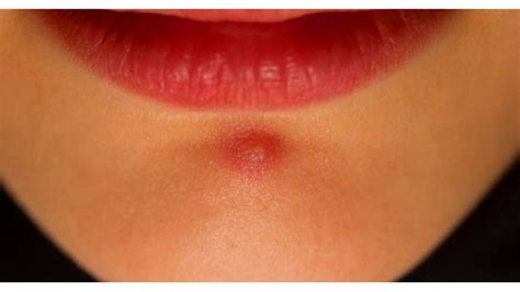 Ketahui Girls, Ternyata Ini yang Jadi Penyebab dan Cara ...