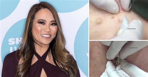 Dr Pimple Popper Is Getting Her Own Tv Show On Tlc Metro News