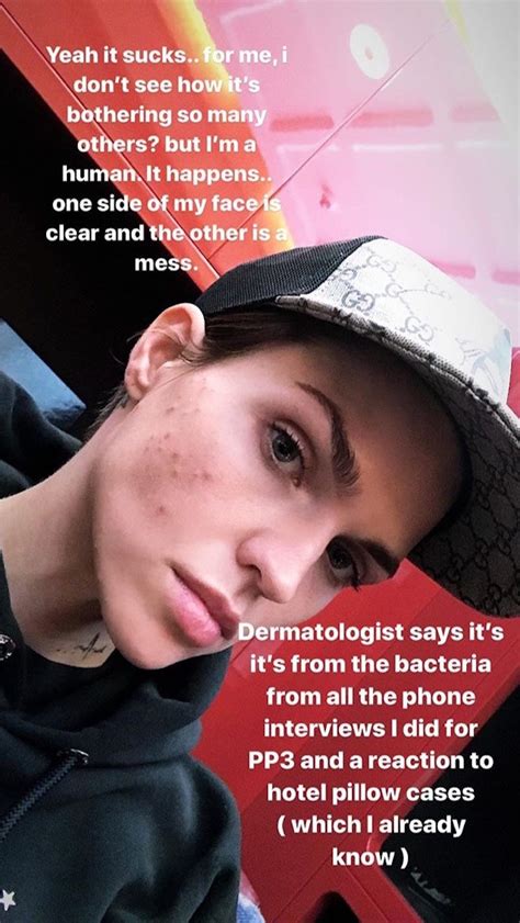 Actress Ruby Rose Bared Her Acne In A Makeup Free Selfie Business Insider