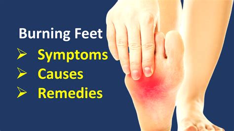 Burning Sensation In Feet Causes And Home Remedies