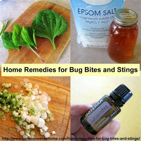 15 Home Remedies For Bug Bites And Stings For Mosquito Bites And More