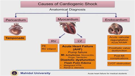 Acute Heart Failure For Medical Student Part 2 สรุปเนื้อหาที่อัปเดต