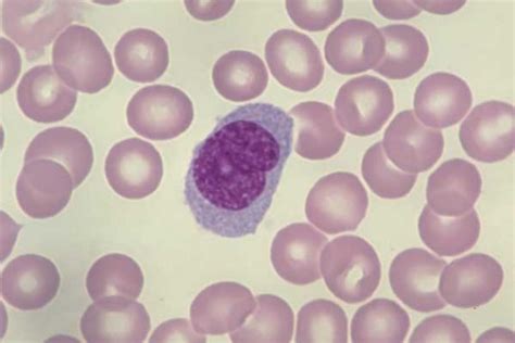 Monocyte With Folded Nucleus Medical Laboratories