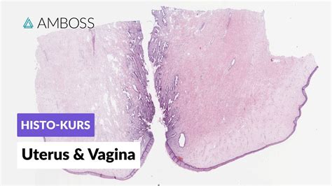 Histologie Uterus Zervix Und Vagina Mikroskopische Anatomie Amboss Video Youtube