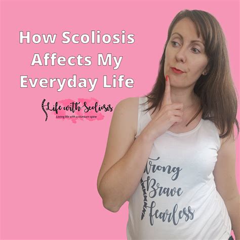 Life After Scoliosis Surgery How Scoliosis Affects My Everyday Life