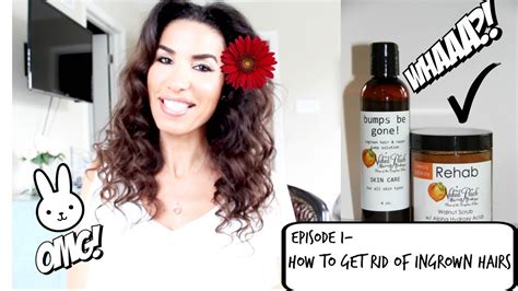 Episode 1 How To Get Rid Of Ingrown Hairs Youtube