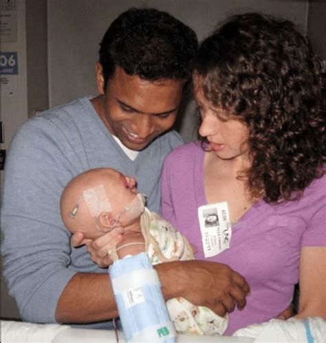 Hospital Staff Adopts Baby With Rare Genetic Disorder After Parents