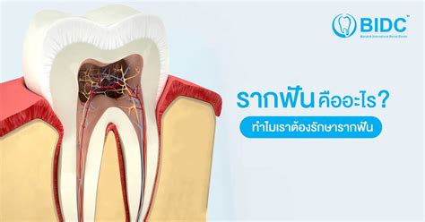 รักษารากฟัน เนื้อเยื่อภายในโพรงประสาทฟัน ข้อควรรู้เกี่ยวกับการรักษา