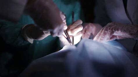 Doctors Surgeons Operate Patient In Stock Footage Sbv Storyblocks