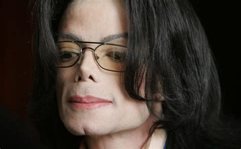Michael Jacksons Autopsy Revealed Numerous Surgical Scars Confirmed
