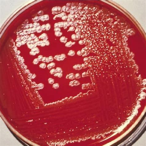 Colonies Of Bacillus Anthracis On Sheep Blood Agar Plate Courtesy Of