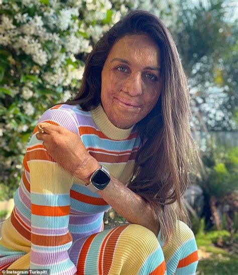 Turia Pitt Reveals Her Minute Rule For Success In The New Year Daily Mail Online
