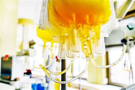 As Short Term Mg Therapy Plasma Exchange May Be Safe Effective
