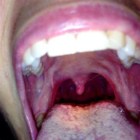 Down The Hatch Throat Uvula Long Tongue Megan Majors Flickr