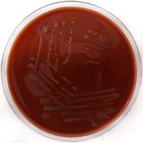 Clostridium perfringens on blood agar. Clostridium tertium on Columbia Chocolate Horse Blood Agar ...