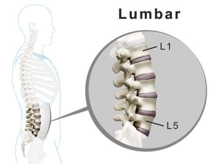 This blog describes what l1 l2 and l3 technical support is. L2-L3 | Treatment For An L2-L3 Without Surgery Or Injections