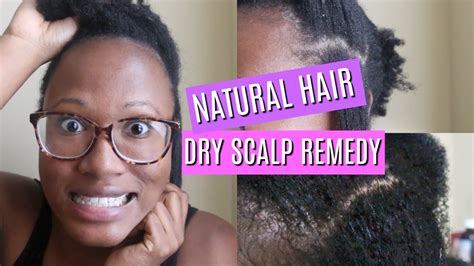 Best Itchy And Dry Scalp Relief Treatment For Natural Hair Youtube
