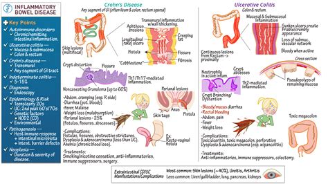 Clinical Pathology Inflammatory Bowel Disease Ulcerative Colitis Crohn S Disease Ditki