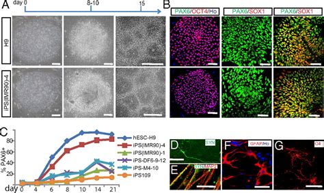 Neural Differentiation Of Human Induced Pluripotent Stem Cells Follows