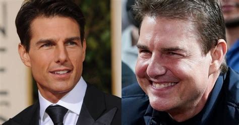 O que aconteceu com o rosto de Tom Cruise Os fãs estão preocupados