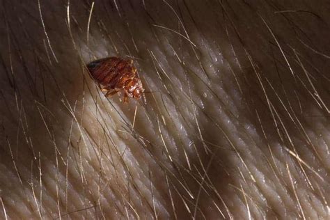 Can Bed Bug Eggs Live In Your Hair Rather Nicely Website Photos