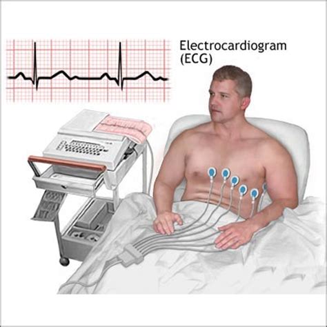 Looking for an ecg test at home in hyderabad? ECG Test - Reasons, Types, Essentiality and Response - Dr ...