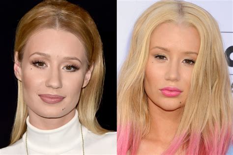 Did Iggy Azalea Get Plastic Surgery On Her Face Page Six