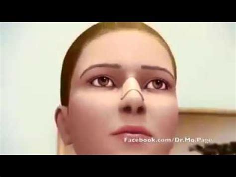 Rinoplastie Operatie Estetica Nas Modelare Nas Chirurgia Nasului