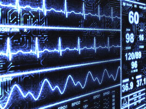 Electrocardiogram Doctor Answers