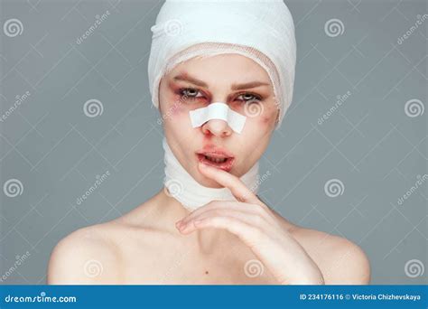 Female Patient Bandaged Face Health Problems Close Up Stock Photo Image Of Injury Beautiful