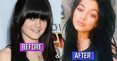 10 Shocking Photos Of Kylie Jenner Before She Became Famous Theinfong