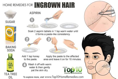 Home Remedies For Ingrown Hair Top 10 Home Remedies