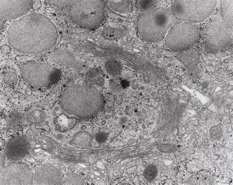 Tem Of Golgi Apparatus In A Human Intestinal Cell Stock Image G460