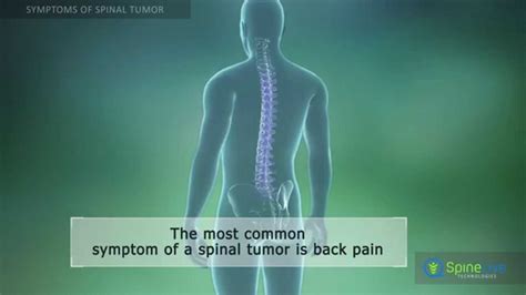 Lower Back Pain Cancer Symptoms Acute Abdominal Pain