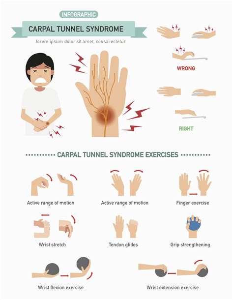 Carpal tunnel syndrome (cts) occurs when the median nerve, one of the large nerves in the wrist, is pinched as it passes through the tight carpal tunnel. Get 13+ 40+ Carpal Tunnel Syndrome Physiotherapy Png vector