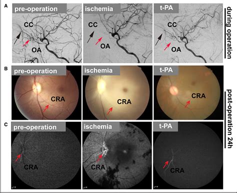 Figure 1 From Novel Acute Retinal Artery Ischemia And Reperfusion Model