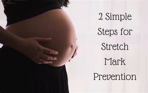 How To Prevent Stretch Marks During Pregnancy Bellatory