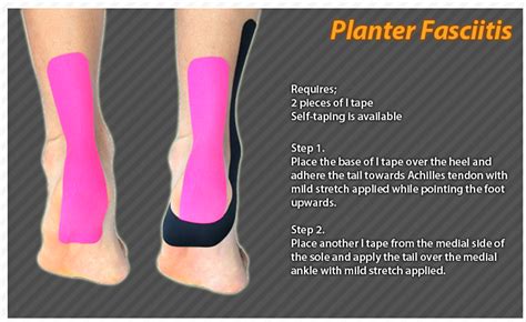 Kinesiology Taping Instructions For Plantar Fascitis Ktape Ares
