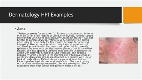 How To Document A Complete History Of Present Illness Hpi Youtube