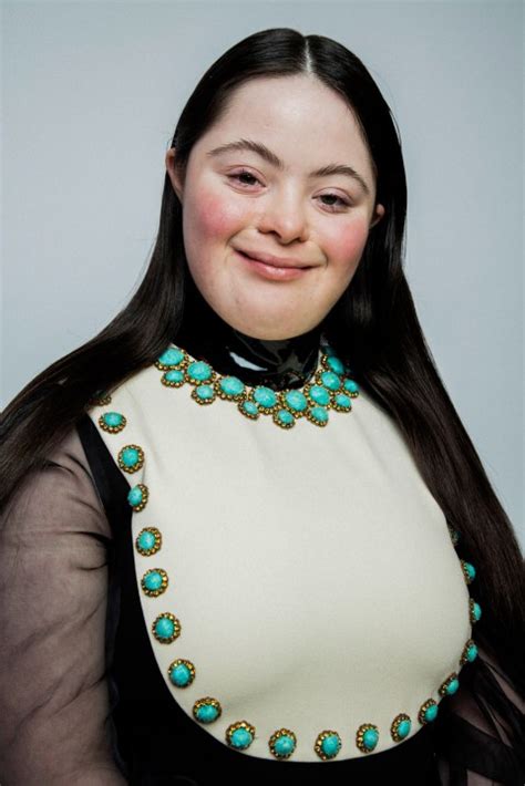 Dus Iz Nies Rare View Ellie Goldstein Jewish Model With Downs Syndrome Lands Campaign
