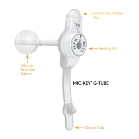 Mic Key Low Profile Gastrostomy Feeding Tube With Secur Lok