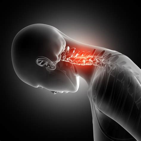Neck Pain Treatments Symptom Causes Exercises Relief At Edison