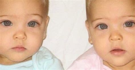 Consideradas As Gêmeas Mais Bonitas Do Mundo Veja Como Elas Cresceram