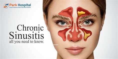 chronic sinusitis all you need to know